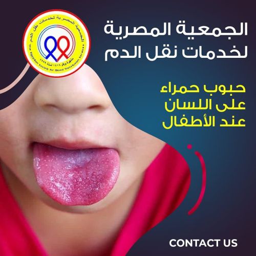 The Egyptian Society for Blood Transfusion Services