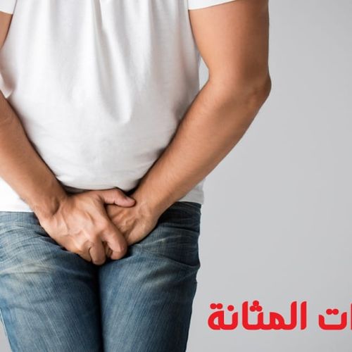 The Egyptian Society for Blood Transfusion Services