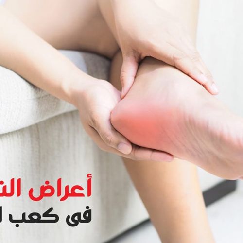 The Egyptian Society for Blood Transfusion Services