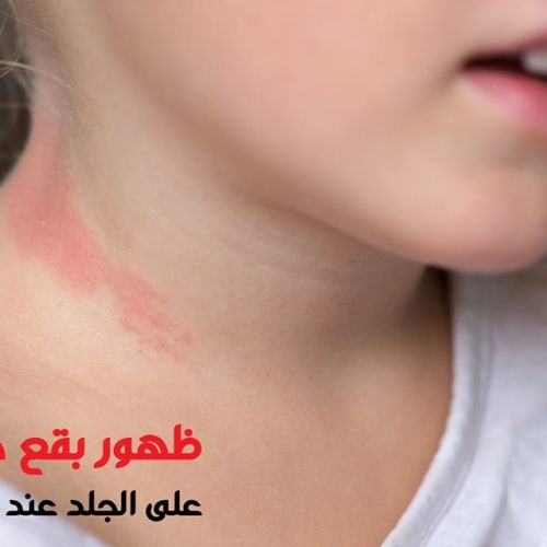 The Egyptian Society for Blood Transfusion Services