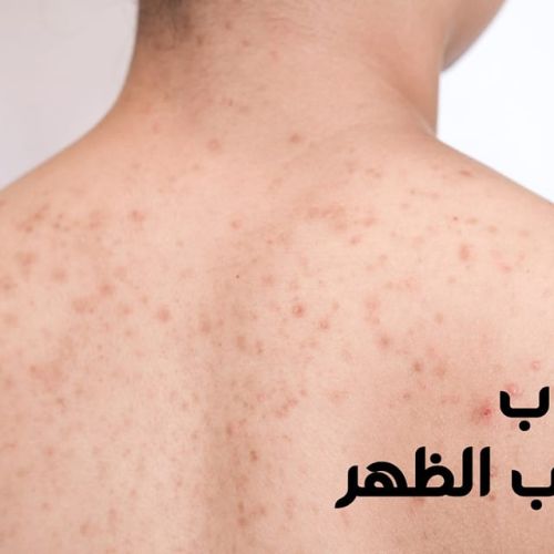 The Egyptian Society for Blood Transfusion Services