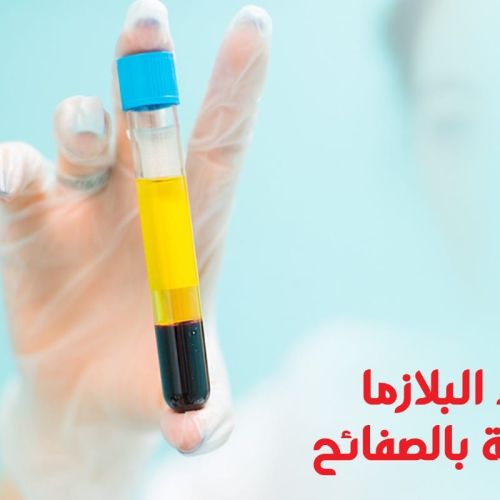 The Egyptian Society for Blood Transfusion Services