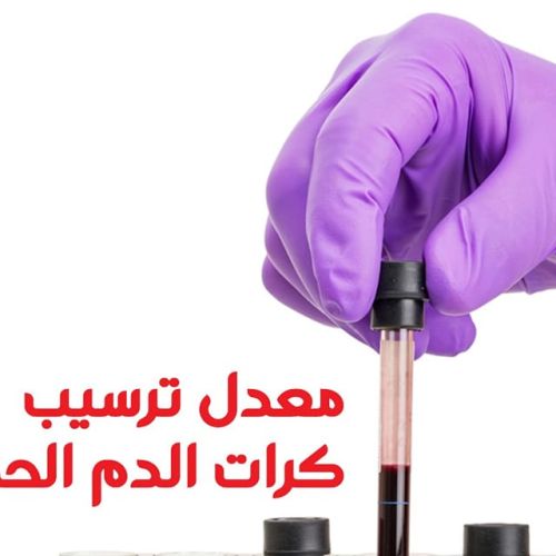 The Egyptian Society for Blood Transfusion Services