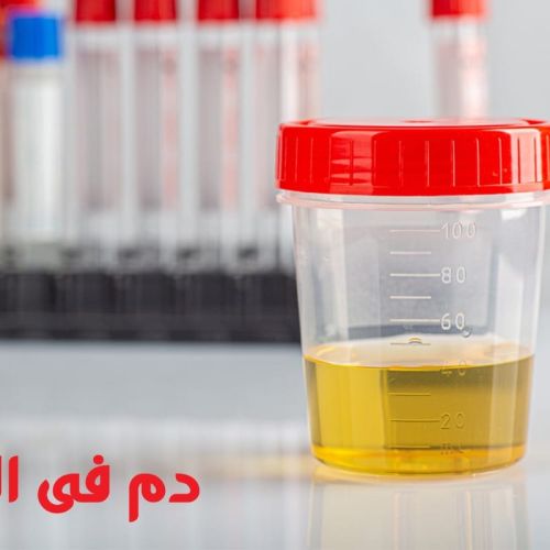 The Egyptian Society for Blood Transfusion Services