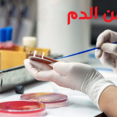 The Egyptian Society for Blood Transfusion Services