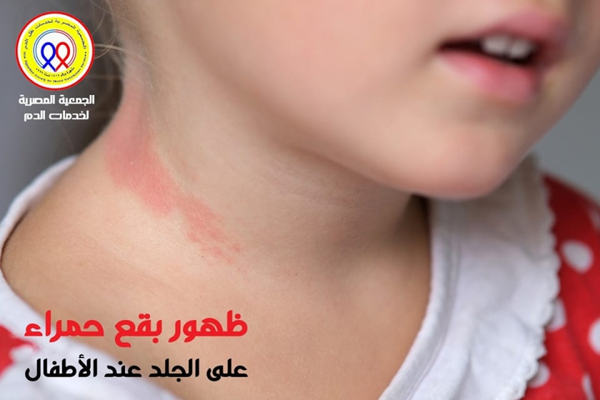 الجمعية المصرية لخدمات نقل الدم