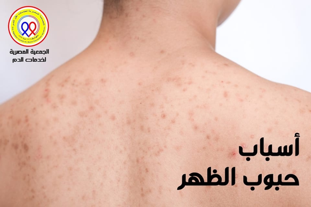 الجمعية المصرية لخدمات نقل الدم