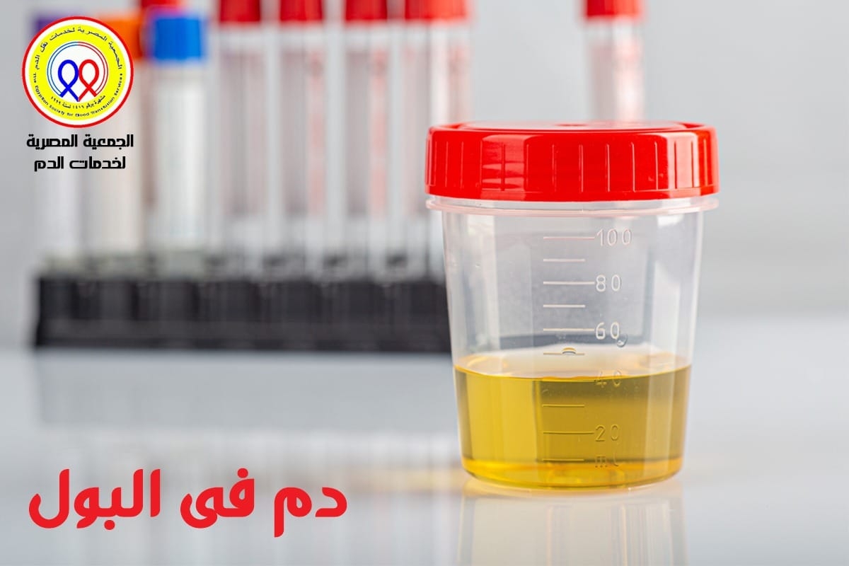 الجمعية المصرية لخدمات نقل الدم