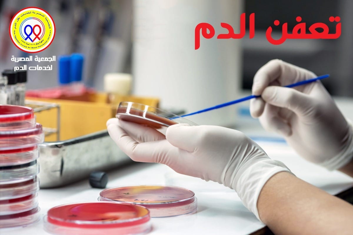 الجمعية المصرية لخدمات نقل الدم