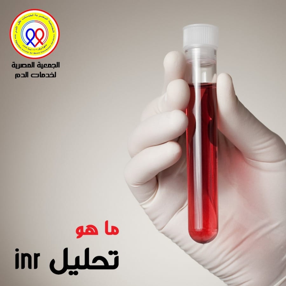 الجمعية المصرية لخدمات نقل الدم