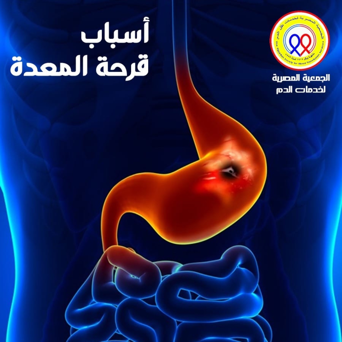 الجمعية المصرية لخدمات نقل الدم