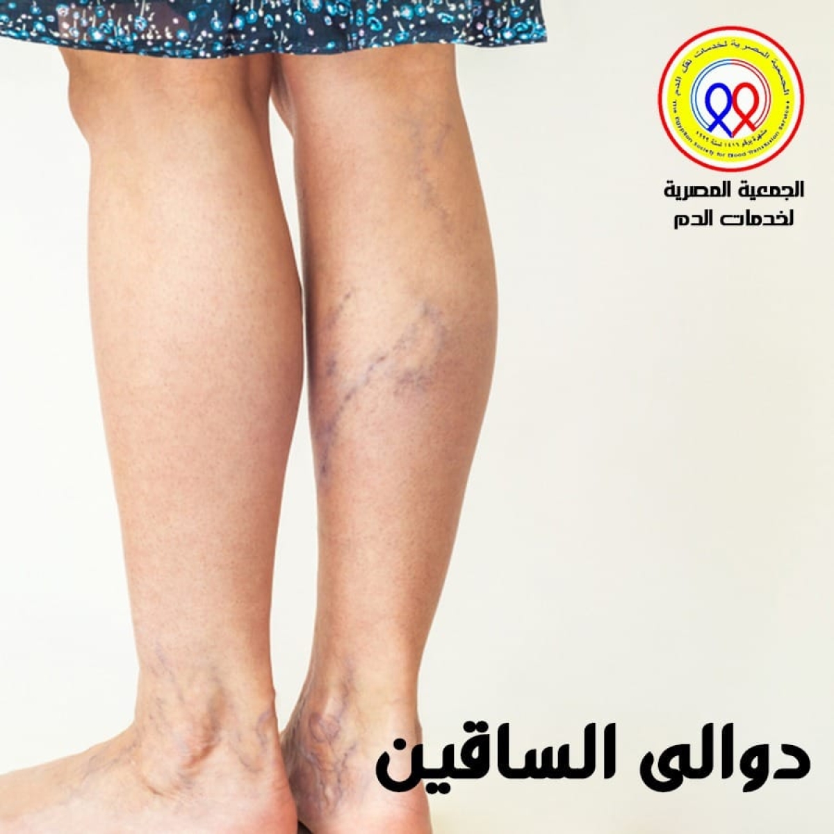 The Egyptian Society for Blood Transfusion Services